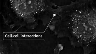 Cells in Action membrane protrusions in HUVECs Human Umbilical Vein Endothelial Cells [upl. by Lorin102]