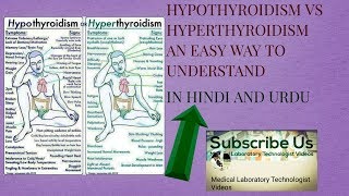 Hypothyroidism vs hyperthyroidism understand in hindi and urdu [upl. by Ewald]