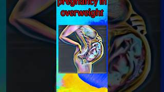 Pregnancy in overweight PART1 [upl. by Alabaster]