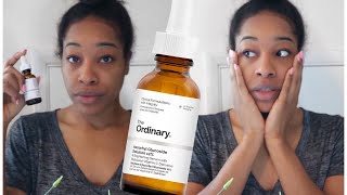 THE ORDINARY VITAMIN C  ASCORBYL GLUCOSIDE  BRIGHTENING SERUM  APPLYING TO SKIN  REVIEW [upl. by Richards]