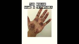 trypophobia disease in human body [upl. by O'Hara725]