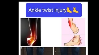 simple exercises for ankle sprain [upl. by Kcirdneh]