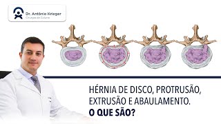 Hérnia de disco protusão extrusão e abaulamento discal O que são [upl. by Lida781]