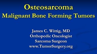 Orthopedic Oncology Course  Malignant Bone Forming Tumors Osteosarcoma  Lecture 4 [upl. by Murvyn]