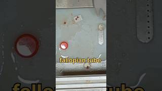 Fallopian tube biopsy 🧐 sample  sterilization [upl. by Fortunato972]