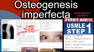 Osteogenesis imperfecta  Dentinogenesis imperfecta in HindiUrdu by first aid for USMLE step 1 [upl. by Aya141]