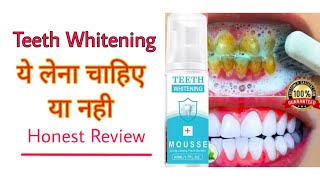 Teeth whitening  Mousse Teeth whitening  Teeth pain Solution  teeth cleaning [upl. by Neeloj]