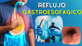 🔥 ERGE Causas Diagnostico y Tratamiento de la Enfermedad por Reflujo Gastroesofágico  Podcast [upl. by Renate]