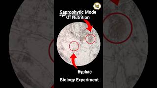 Growth of Rhizopus Fungi  Saprophytic Mode of Nutrition  Experiment based Learning [upl. by Alemap]