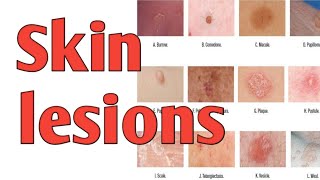 Primary skin lesionsdermatology nursingstudy 7 may 2020 [upl. by Mcgaw]