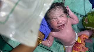 Newborn baby girl 👧 viral video viralvideo trending cute doctorbantu [upl. by Kobe]