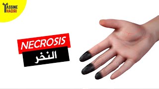 موت الأنسجة ☠️ Apoptosis vs Necrosis [upl. by Aramac]