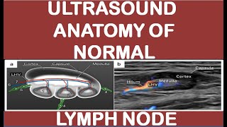 Ultrasound anatomy of normal lymph node [upl. by Selrahc]