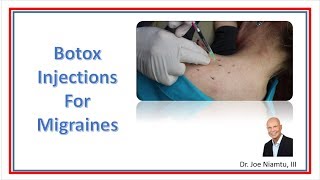 Botox Injections for Migraines [upl. by Asecnarf]