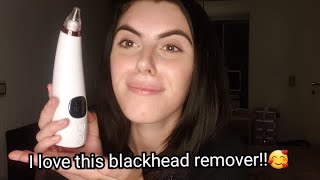 how do i use a microcrystalline blackhead remover [upl. by Nazay]