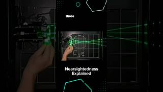 Nearsightedness Explained 👀 [upl. by Anyak]