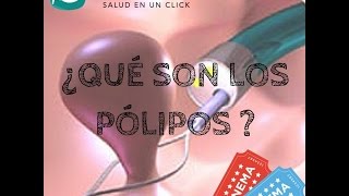 ¿Qué son los Pólipos [upl. by Enneles]