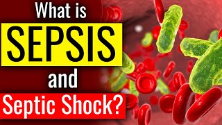 What is SEPSIS and SEPTIC SHOCK  The Bodys Deadly response to Infection Sepsis  Cause Symptom [upl. by Weissberg]