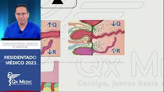 Obstetricia  5 Estados Hipertensivos [upl. by Columbine]