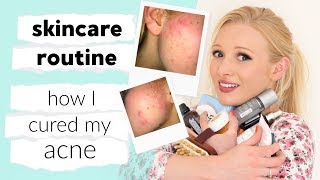 My full skin care routine amp how I CURED my acne [upl. by Neiman]