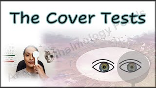 Ophthalmology 355 HeteroTropia Strabismus Squint ConComitant Comitant Hirschberg Test Cover [upl. by Ahtanoj]