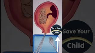 Save your child saveyourchild love cutebaby dampcdrpoonammaggo [upl. by Sida392]