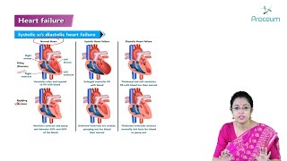 Heart Failure Hindi  Internal Medicine [upl. by Kramer]