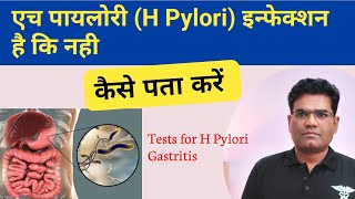 H Pylori Infection की जांच कैसे होती है  Tests for H Pylori Gastritis [upl. by Eycal381]