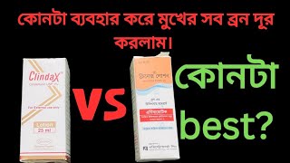 clindax lotion ReviewClinex Lotion ReviewHow to use Clinex LotionHow to use clindax LotionBangla [upl. by Kcirrej]