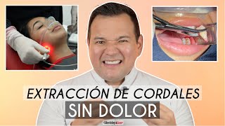 Extracción de Cordales Sin Dolor 🦷  Cirugía sin Dolor ✅ ¿Cómo se hace  Odontología Láser [upl. by Ahsinnek]