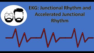 EKG Series Junctional Rhythm Accelerated Junctional Rhythm and Junctional Tachycardia [upl. by Perce]