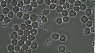 Gránulos de glóbulos blancos en plasma sanguíneo [upl. by Fennessy]