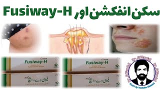 FusiwayH Cream  FusiwayH Best in Skin Infection  DrAHMandal Urdu  Hindi [upl. by Elyac]