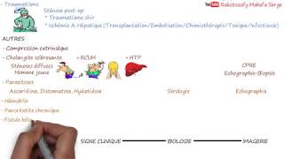 ICTÈRE A BILIRUBINE CONJUGUÉE CHEZ LADULTE  Cholestase extrahépatique [upl. by Aerdnwahs]