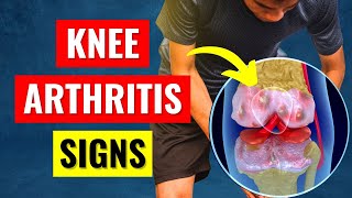 Knee Pain Arthritis Symptoms  What You Need To Know [upl. by Ltney]