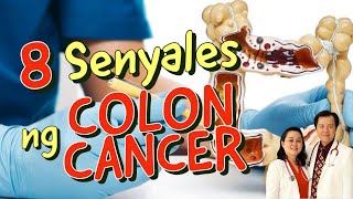 8 Senyales ng Colon Cancer  Payo ni Doc Willie Ong [upl. by Anatole43]