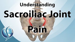 Understanding Sacroiliac Joint Pain [upl. by Castorina892]