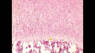 Endochondral ossification cancellous spongy bone long bone LS [upl. by Tnecillim514]