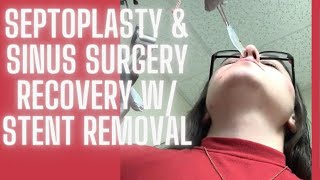 Recovery amp  STENT REMOVAL  after SEPTOPLASTY amp SINUS SURGERY  TURBINATE REDUCTION [upl. by Liana]