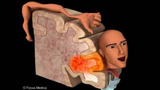 Primary Motor Cortex  Neuroanatomy [upl. by Aihsercal986]