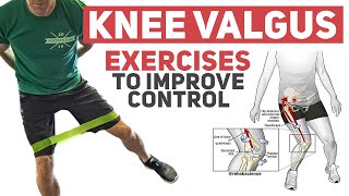 Knee Valgus  Rehab Exercises to Improve Movement Control [upl. by Chenee]