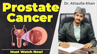 Prostate Cancer Kya Hai  Dr Attaullah Khan [upl. by Cavil]