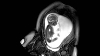 Foetal Development Unborn Baby Movement at 24 Weeks  WIRED [upl. by Leal552]