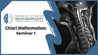 Chiari Malformation Seminar 1 [upl. by Pozzy765]