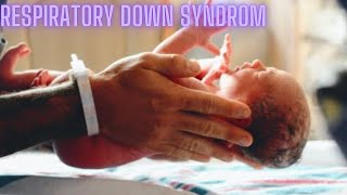 what is the respiratory down syndrom [upl. by Nroht]