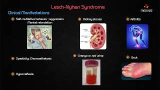 LeschNyhan syndrome  Usmle step 1 Biochemistry Case Based discussion [upl. by Akinimod]