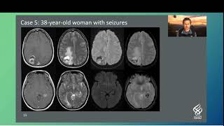 Interesting Cases Neuroradiology [upl. by Honeyman646]