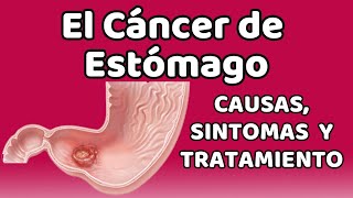 EL CÁNCER DE ESTÓMAGO Causas signos y síntomas diagnóstico y tratamiento [upl. by Jarl]