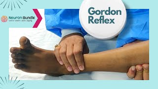 Gordons Reflex alternative to Babinskisign cns neurology extensorplantar medschool [upl. by Roscoe156]