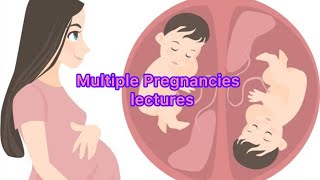 Multiple Pregnancy Lecture part 2 ، Aetiology Classification and Care of Multiple Pregnancy obs [upl. by Kam]